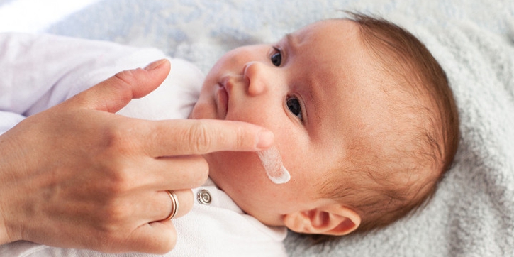 Pentingnya Menjaga Kelembapan Kulit Si Kecil yang Terkena Dermatitis Atopik