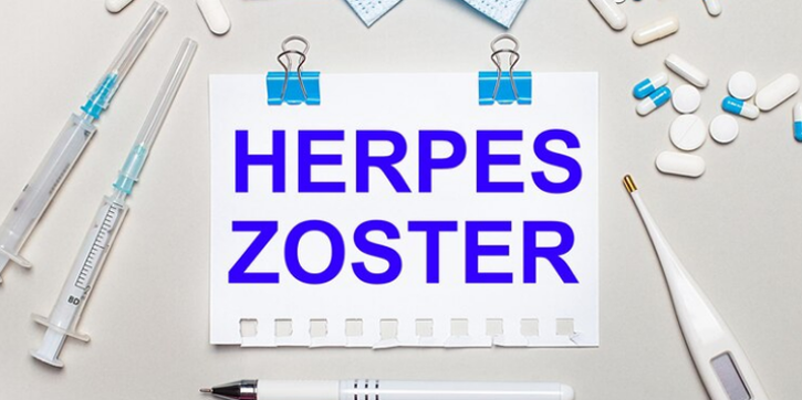 Menurut Dokter Kulit, Ini 7 Fakta Unik Seputar Cacar Ular atau Herpes Zoster