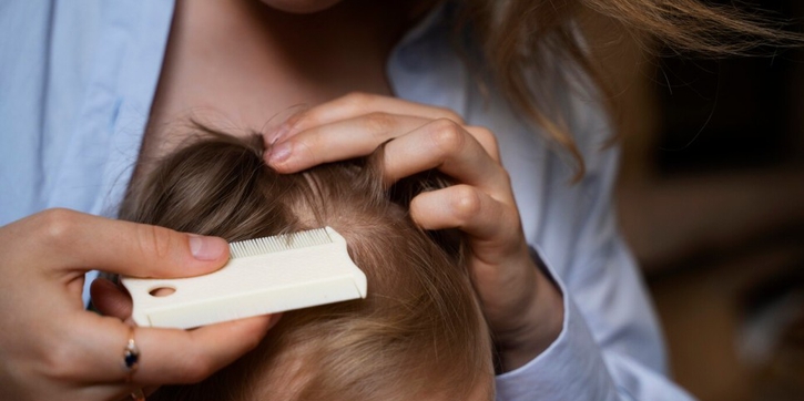 5 Cara Menghilangkan Ketombe pada Bayi