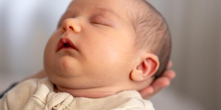 Ciri-Ciri Hidrosefalus pada Bayi yang Wajib Anda Kenali