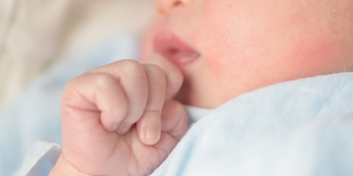 7 Penyebab Pipi Bayi Alami Kemerahan dan Menjadi Kasar