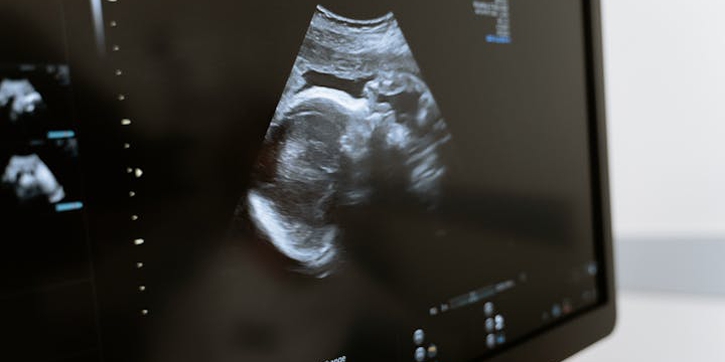 Firasat Ibu tentang Jenis Kelamin Bayi, Mitos atau Fakta?