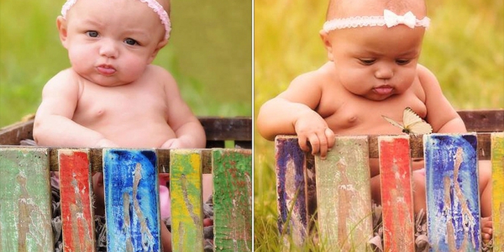 Bayi Kembar Ini Sangat Berbeda