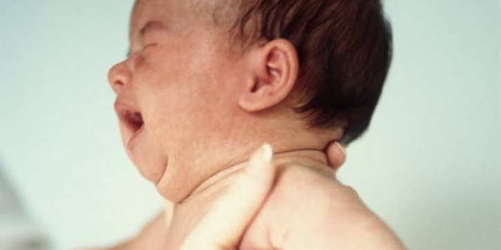 Bayi Lebih Sensitif Terhadap Rasa Sakit