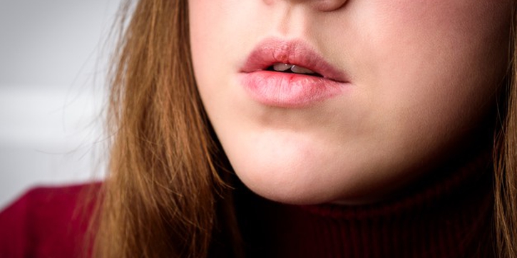 Bibir Lebih Tebal dan Gelap saat Hamil? Ini Penyebabnya, Moms
