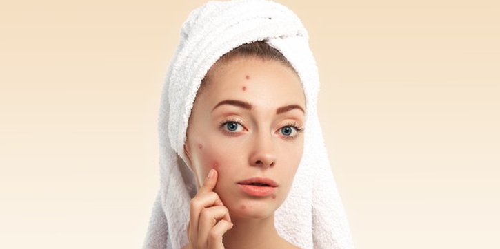 5 Acne Patch untuk Atasi Jerawat Tanpa Ganggu Penampilan