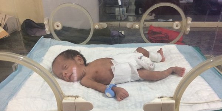 Aksesori Penting untuk Bayi Prematur