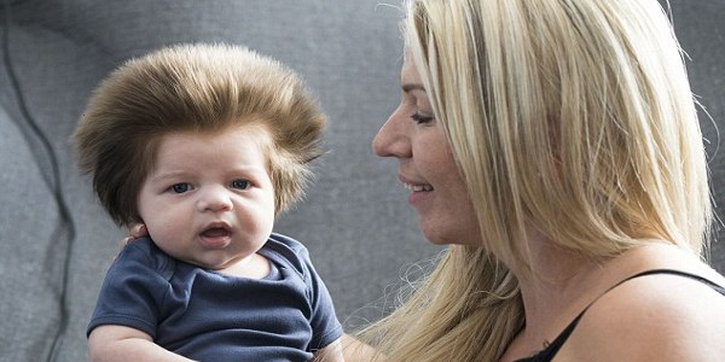 Bayi Berambut Lebat Menarik Perhatian Banyak Orang