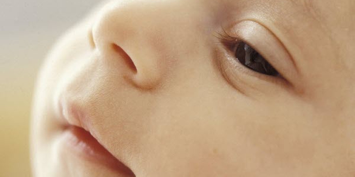 Atasi Mata Lengket pada Bayi