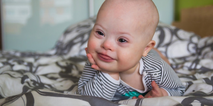 Perlu Tahu, Ini 8 Sindrom yang Bisa Dialami Bayi