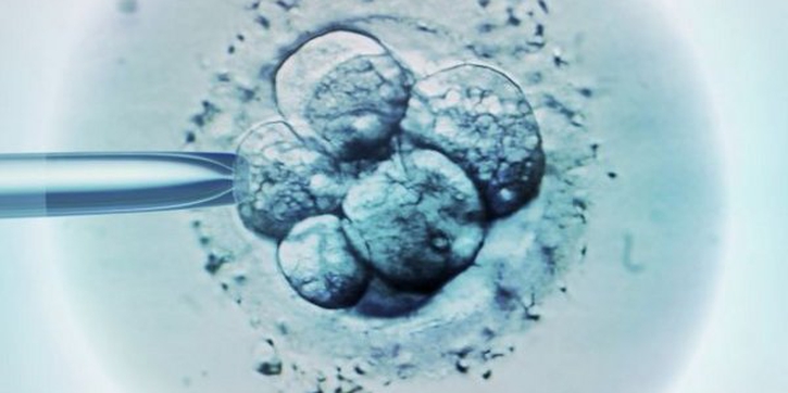 Tes DNA Tingkatkan Keberhasilan IVF