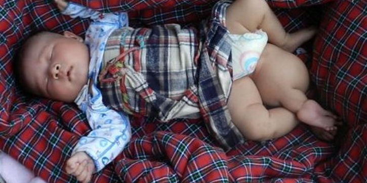 Bayi Lahir dengan Tiga Kaki
