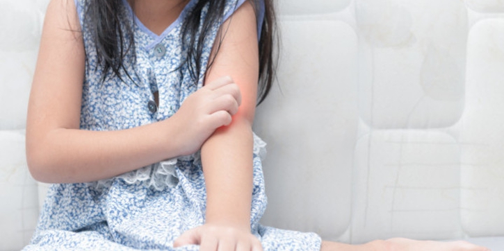 7 Penanganan Tepat saat Anak Terkena Ulat Bulu