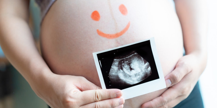 10 Hal yang Harus Moms Lakukan Sebelum Bayi Anda Lahir