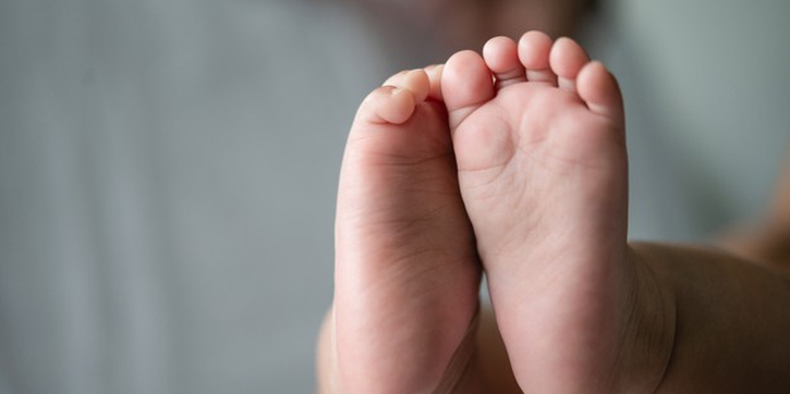 Mengenal Pigeon Toe atau Kaki Seperti Burung pada Bayi