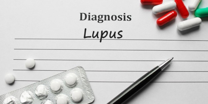 Hari Lupus Sedunia, Ini 5 Fakta Seputar Penyakit Lupus