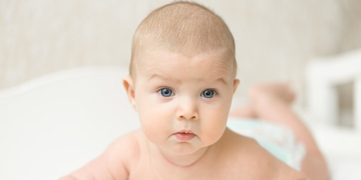 Craniosynostosis, Kelainan Tulang Tengkorak Kepala Bayi