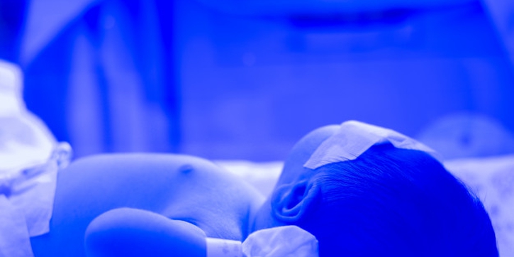 Bayi Kuning, Cukup Dijemur Saja atau Harus Dirawat?
