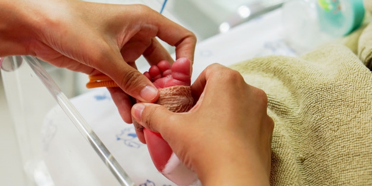 Kulit Bersisik, Bayi Ini Miliki Sindrom Harlequin Ichtyosis