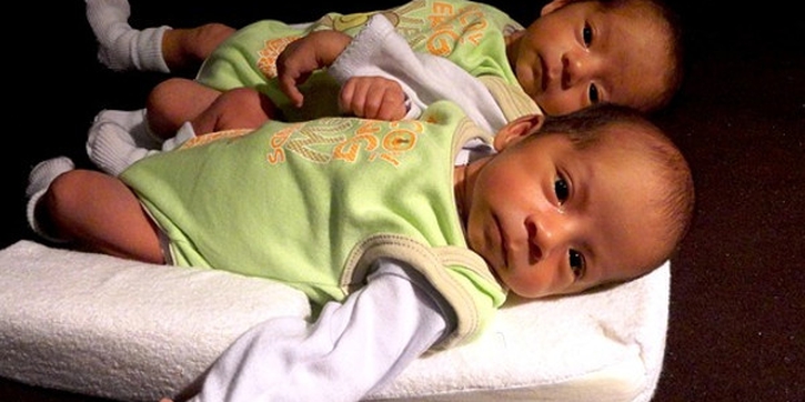 Ini Penyebab Bayi Lahir Kembar Siam