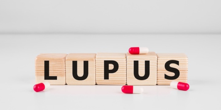 Waspadai 8 Gejala Awal Lupus pada Anak dan Remaja