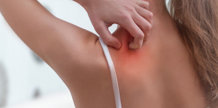 Psoriasis saat Hamil, Adakah Dampaknya pada Janin?