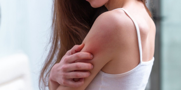 Dermatitis Atopik pada Orang Dewasa, Ini Cara Mengatasinya