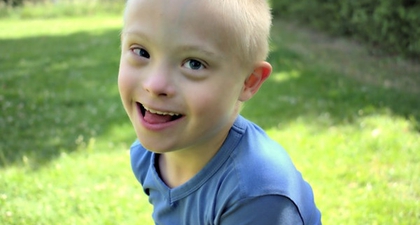 10 Fakta Down Syndrome pada Balita