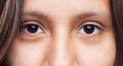 Kenali Penyebab Kebutaan, Retinopati Diabetika
