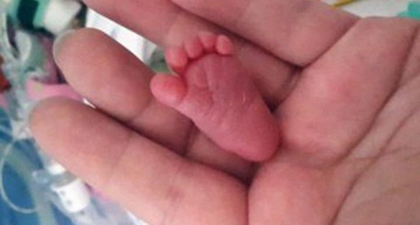 Emilia Si Bayi Termungil di Dunia