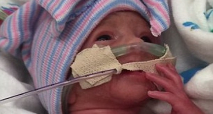 Bayi Kembar Lima Lahir di Amerika