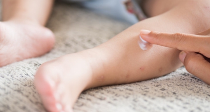 Campak pada Bayi, Kenali Gejala dan Penanganannya, Moms