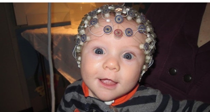 Diagnosis Autisme Sejak Dini dengan EEG Sederhana
