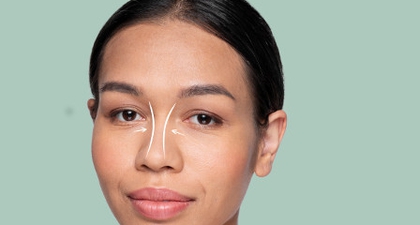 Jangan Tergiur Hasilnya, Kenali Dulu Risiko Tanam Benang Hidung