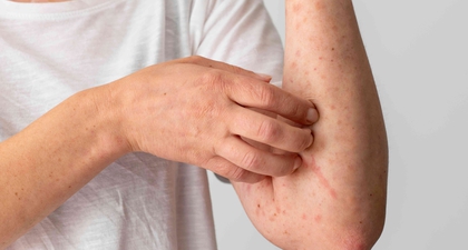 Jangan Keliru, Ini Perbedaan Campak dan Rubella yang Moms Perlu Tahu