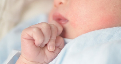 Kenali 7 Jenis Bintik Merah pada Bayi dan Cara Mencegahnya dengan Tepat