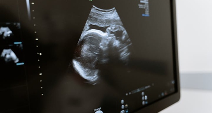 Firasat Ibu tentang Jenis Kelamin Bayi, Mitos atau Fakta?