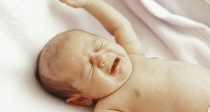 3 Trauma Lahir pada Kulit Bayi