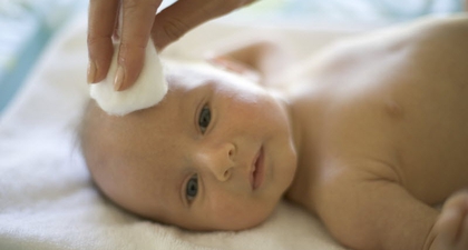 Jika Kulit Wajah Bayi Kasar