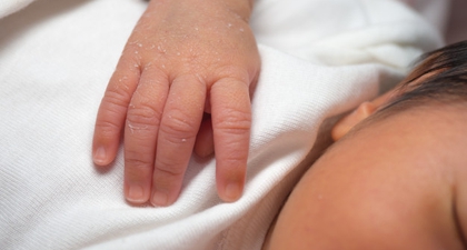 Kulit Bayi Baru Lahir Mengelupas, Ini Penyebab dan Cara Atasinya