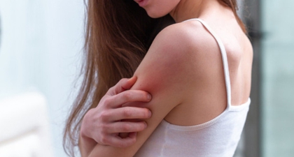 Dermatitis Atopik pada Orang Dewasa, Ini Cara Mengatasinya