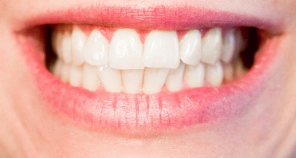 Konsumsi 5 Makanan Ini agar Gigi Putih