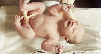 Trauma Lahir (3): Pada Wajah Bayi