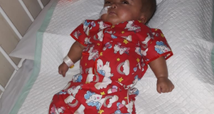 Perjuangan Lalita Melawan Hidrosefalus