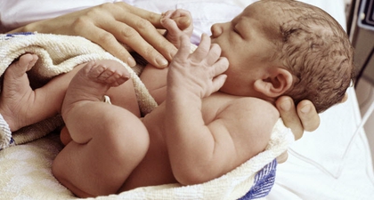 Trauma Lahir (2): Pada Kepala Bayi