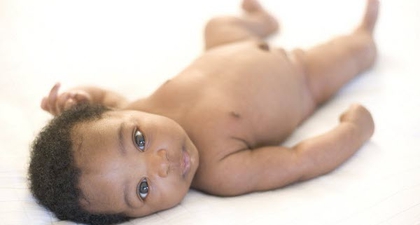 Sunat bagi Bayi