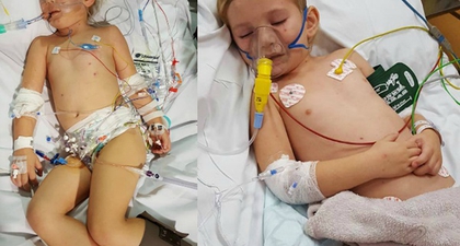 Hanya Dalam 24 Jam, Meningitis Melumpuhkan Balita Ini!