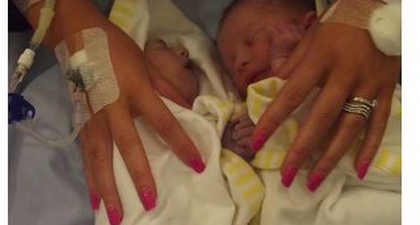 Bayi Pendonor Organ Termuda di Inggris