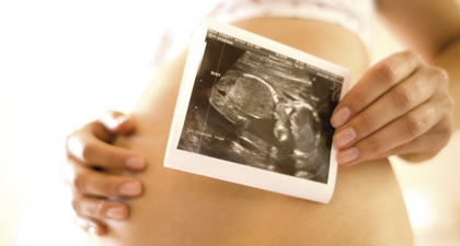 Kegemukan saat Hamil Pengaruhi IQ Anak?