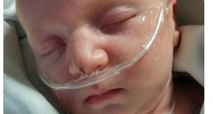Bayi dengan Lubang di Jantung Tidak Mampu 'Beli' ASI